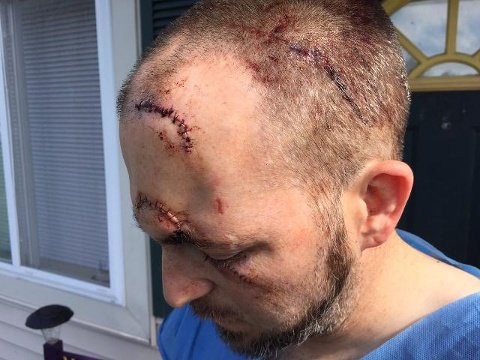 dave moschel vikings stabbing